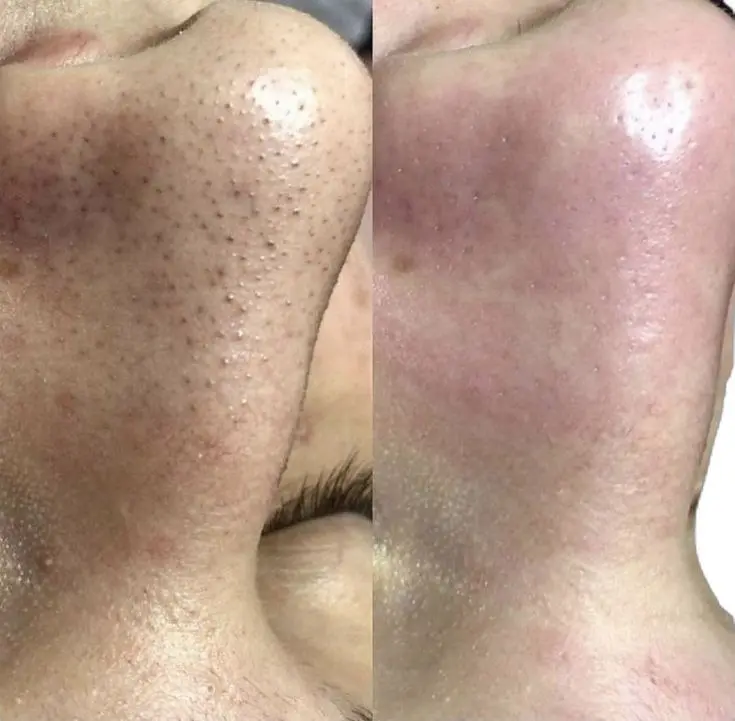 نمونه قبل و بعد مراقبت پوست بدن
